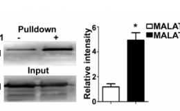 RNA Pulldown、DNA Pull-down