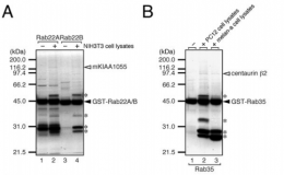 蛋白相互作用分析