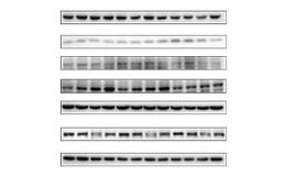 蛋白质免疫印迹（Western Blot，WB ）