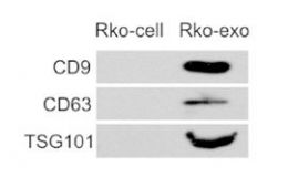 WB验证外泌体靶蛋白
