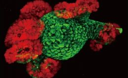 类器官基因过表达（慢病毒）套餐